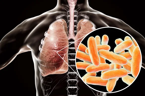 Outbreak Warning Issued As Number Of Sydney Residents Admitted To Hospital