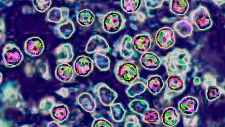 Warning Issued After Virus Infected Person Visits Different Locations in Sydney