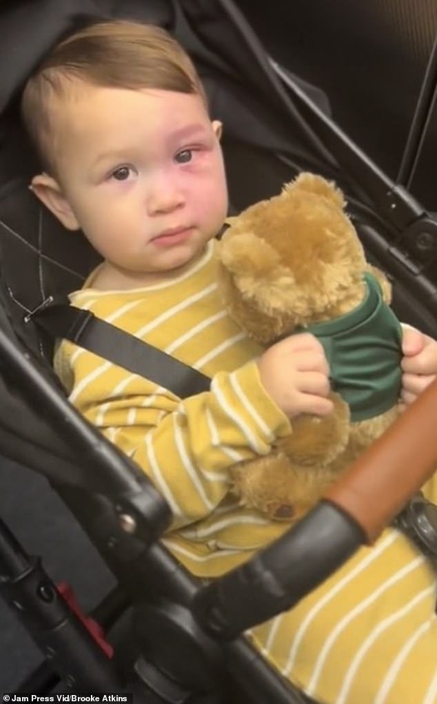 Aussie Mum Slammed For Lasering Her Baby's Birthmark Share New Photos second image