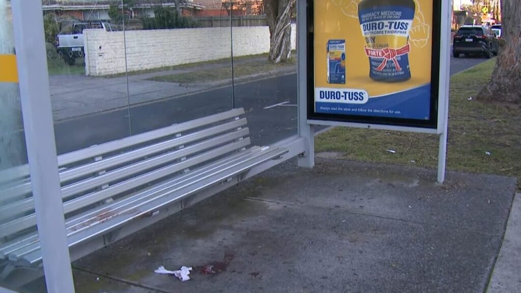 Aussie Teen Stripped And Beaten While Waiting For A Bus