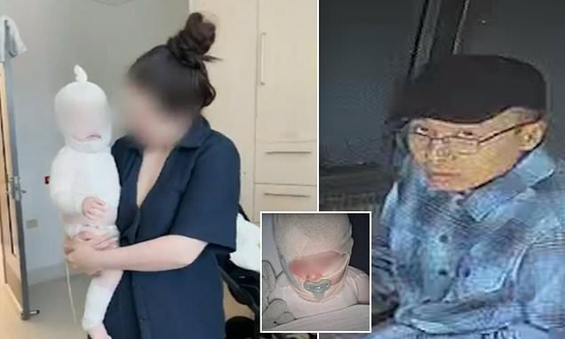 Major New Update After Horror Braby Hot Coffee Attack second image