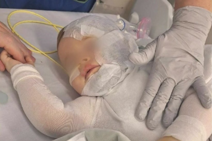 Mums Plea One Year After Stranger Poured Hot Coffee Over Her Baby