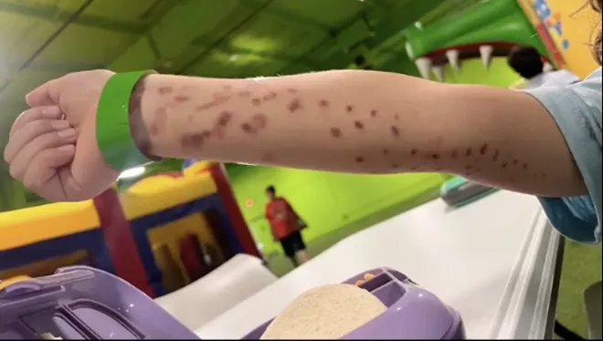 Octopus 'Tries To Eat' 6-Year-Old Boy At Aquarium second image