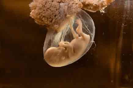 Baby Born From 30 Years Old Frozen Embryo