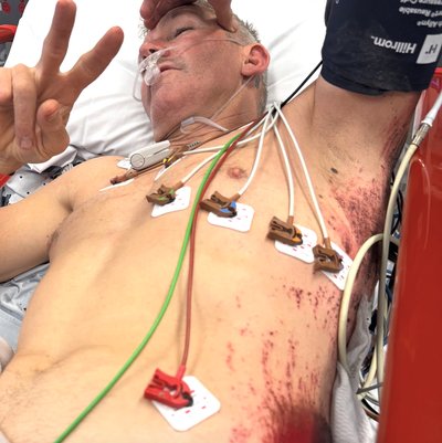 Aussie World Champion Rushed To Hospital With Internal Injuries second image