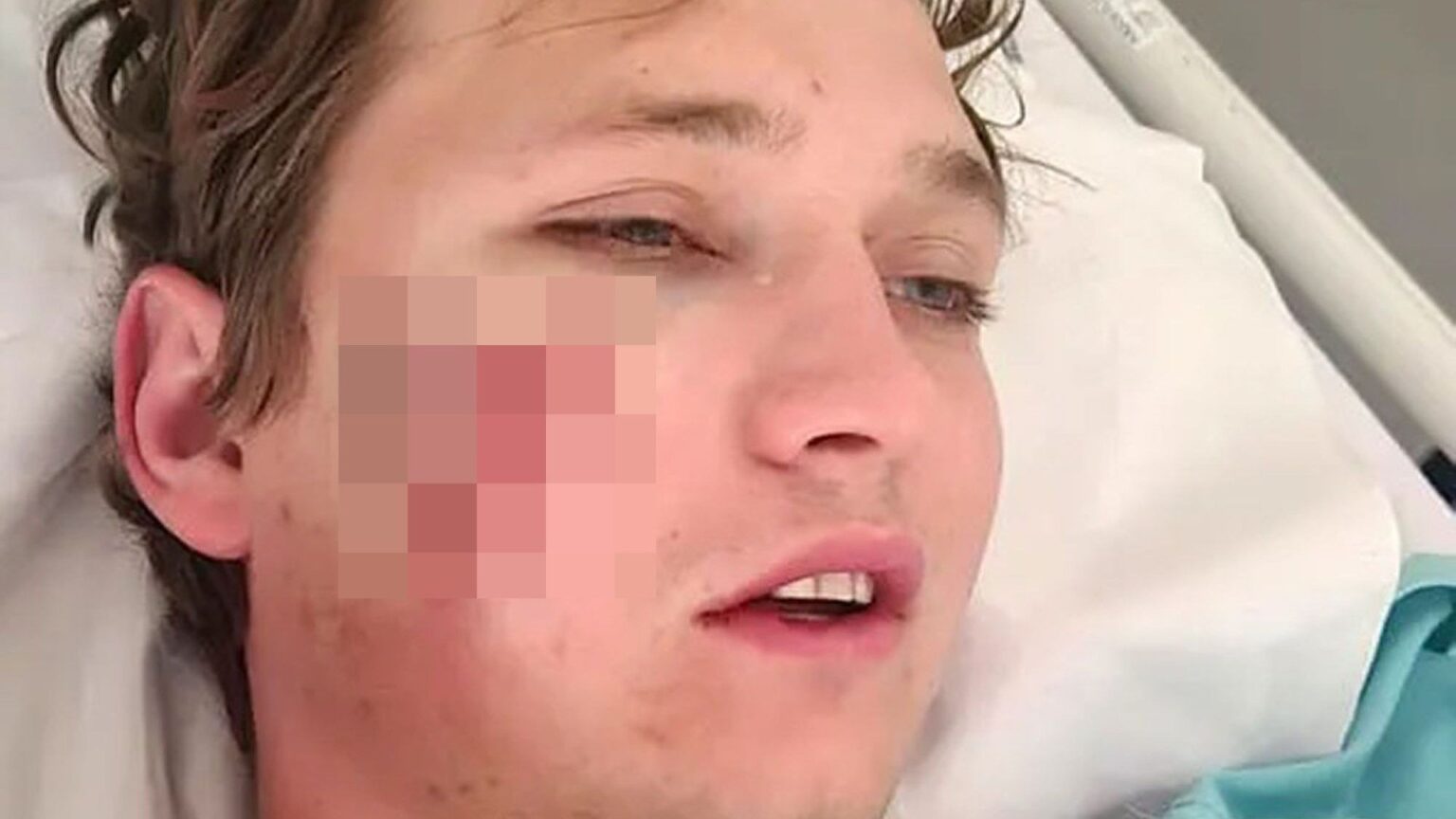 27yo Dragged From His Tent And Mauled