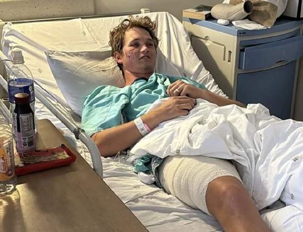 27yo Dragged From His Tent And Mauled second image