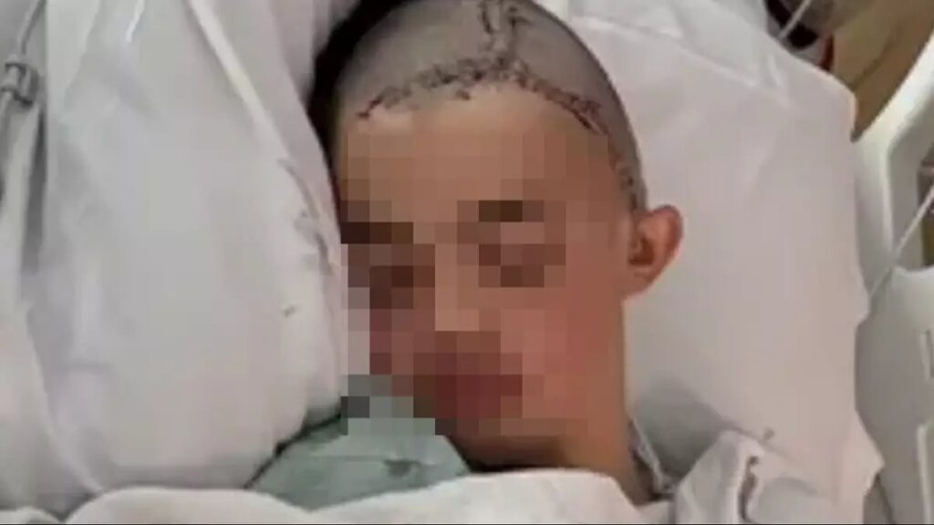 Boy Has Scull Removed After Brutal School Cafeteria Confrontation