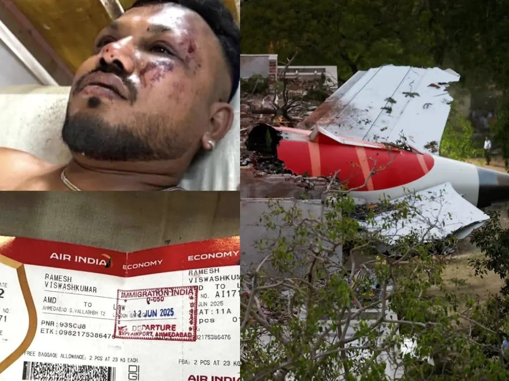 Heartbreaking Update On Air India’s Only Survivor