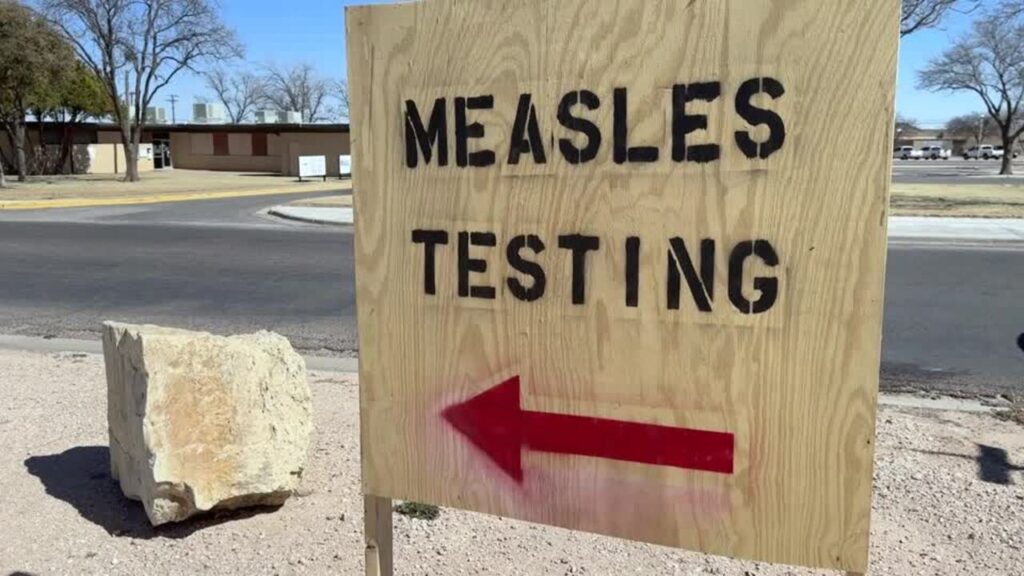 Measles Outbreak Fear As Bali Traveller Sparks Urgent Warning In Australia