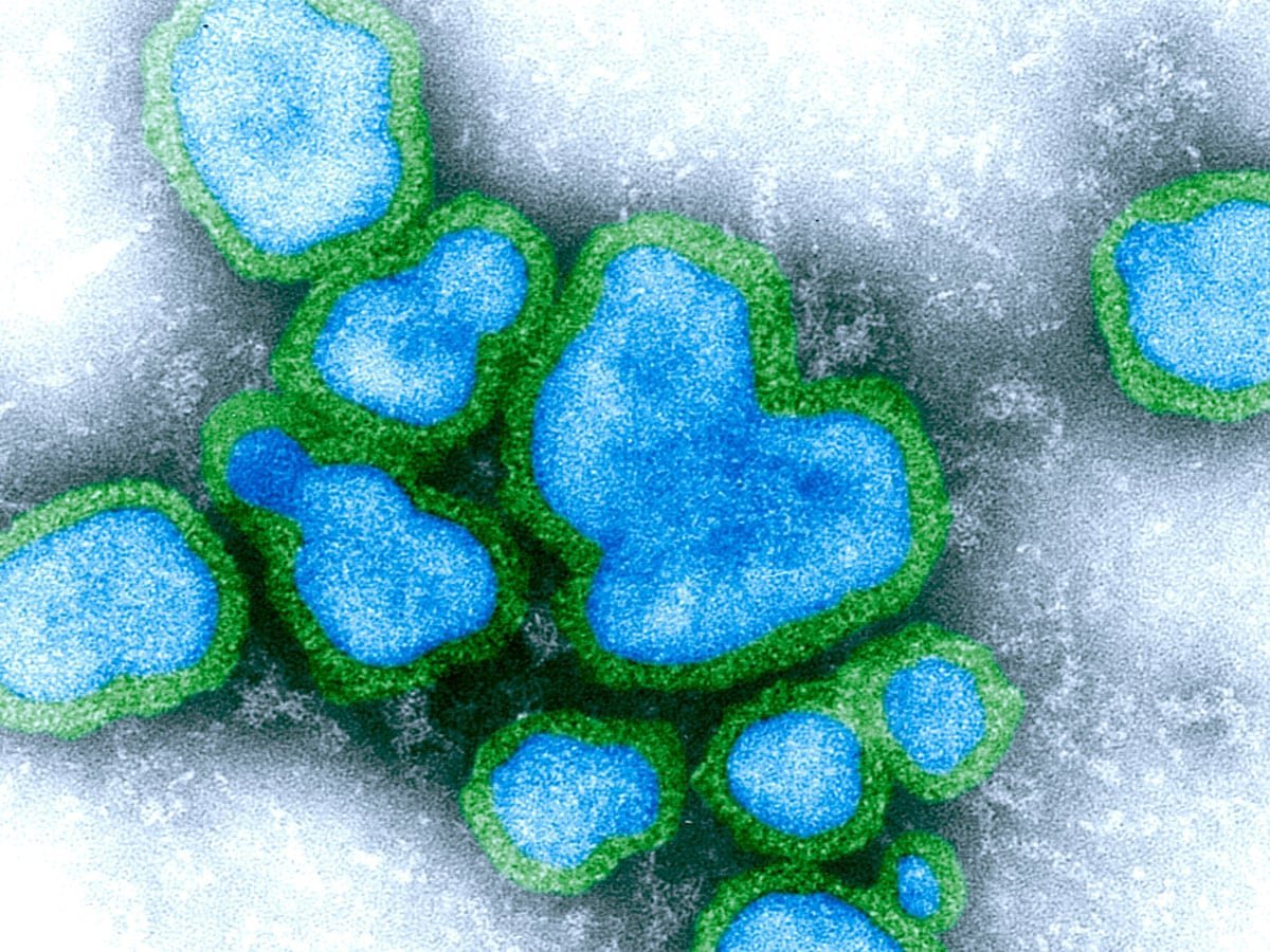 NT Flu Outbreak Claims 14 Lives as Doctors Issue Desperate Plea second image