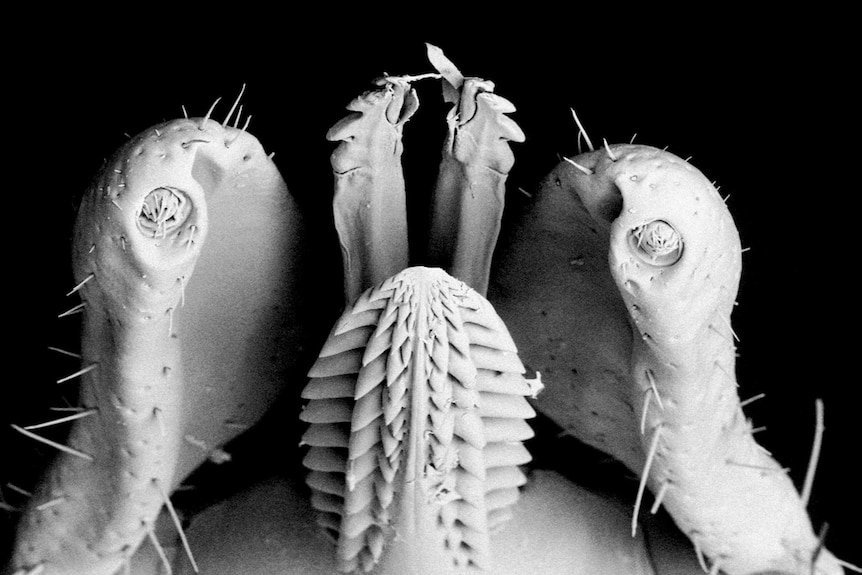 Chronic Illness Epidemic Grips Australia Thousands Left in Agony