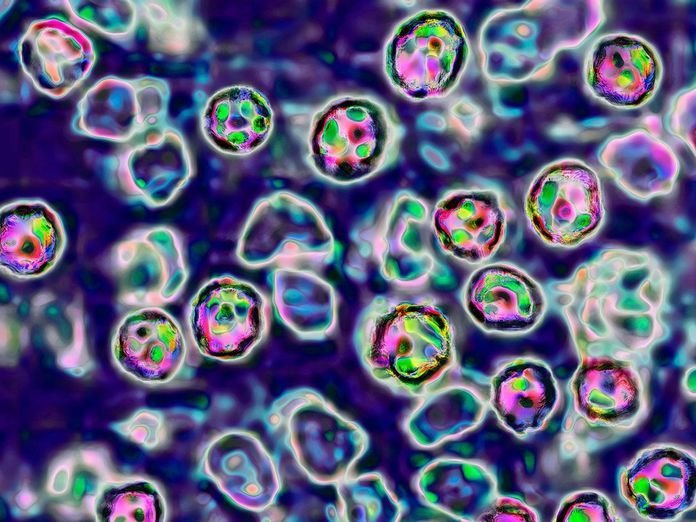 Measles Outbreak Sparks Chaos in NSW and WA