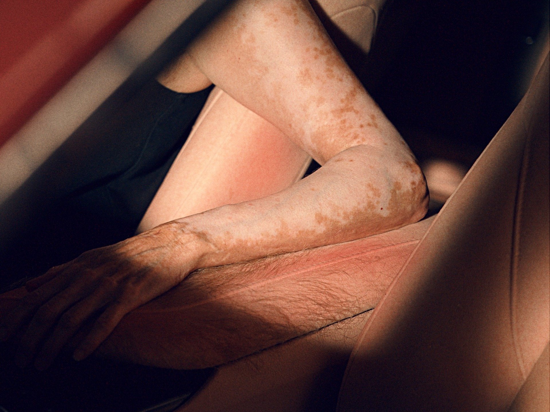 SHOCKING "Human Skin" Car Wrap Exposes Hidden UV Dangers to Aussie Drivers - Second Image