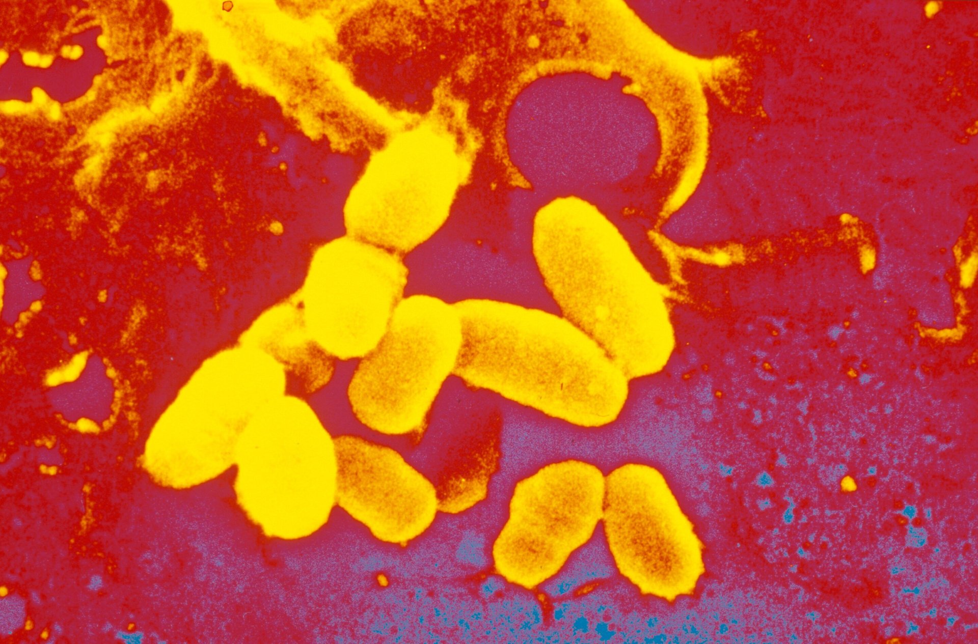 Deadly Diphtheria Outbreak Spreads Across Australia - Second Image