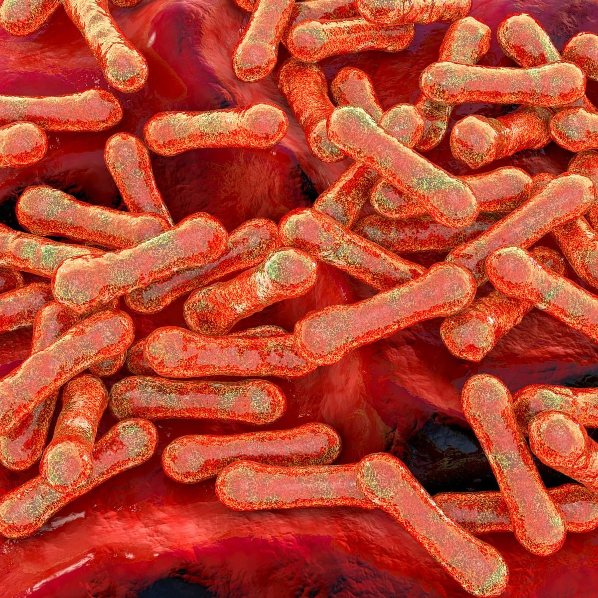 Diphtheria Death Toll Rises in NT Outbreak - Second Image