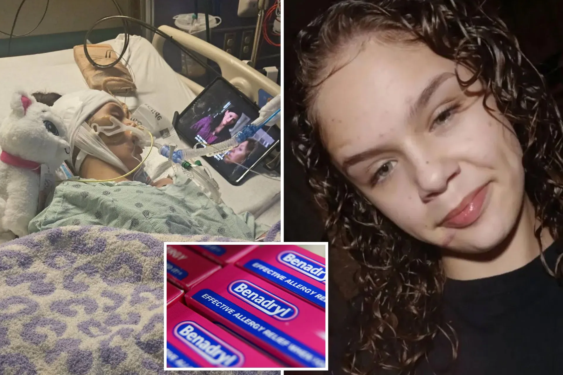 Teen's Desperate Fight for Life as 'Benadryl Challenge' Turns Deadly - Second Image