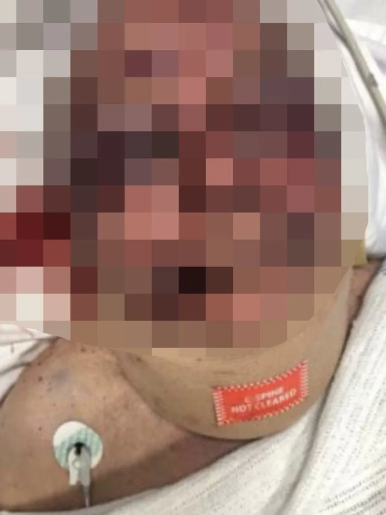 Horrific Aged Care Bashing Sparks Outrage in Sydney Facility - Second Image
