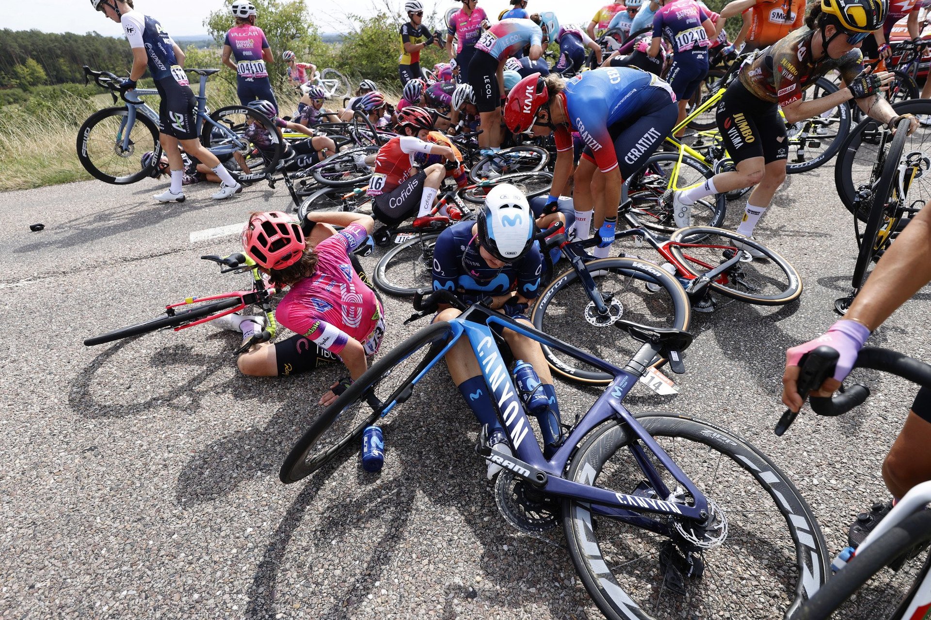 Cyclist Breaks His Jaw In Crash