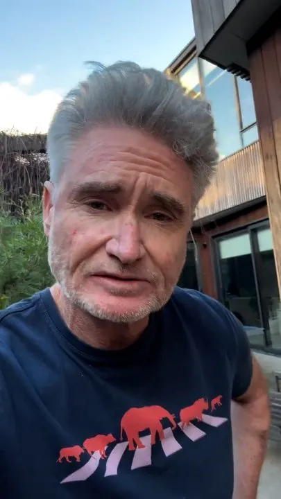 Hughesy not afraid of the backlash After Albo Rant