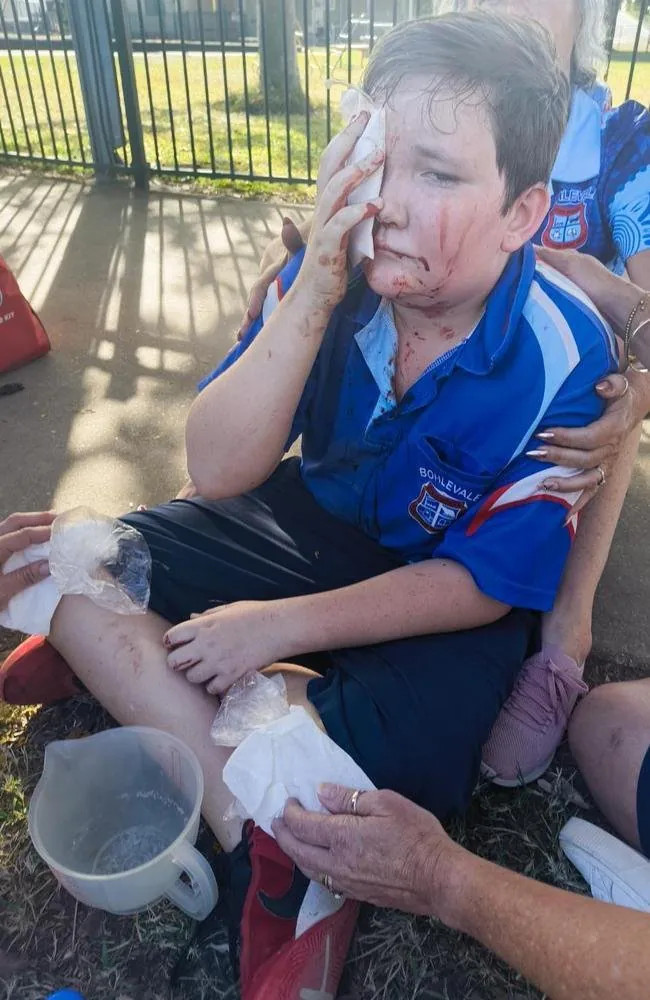 Boy, 10, Left for Dead in Brutal E-Scooter Smash in Queensland - Second Image