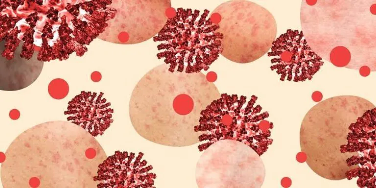 A Biblical Disease Making a Comeback in US