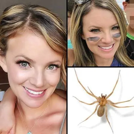 Mum-of-Four Fights for Life After Deadly Spider Bite