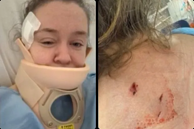Mum Stabbed 4 Times in Melbourne  Speaks Out