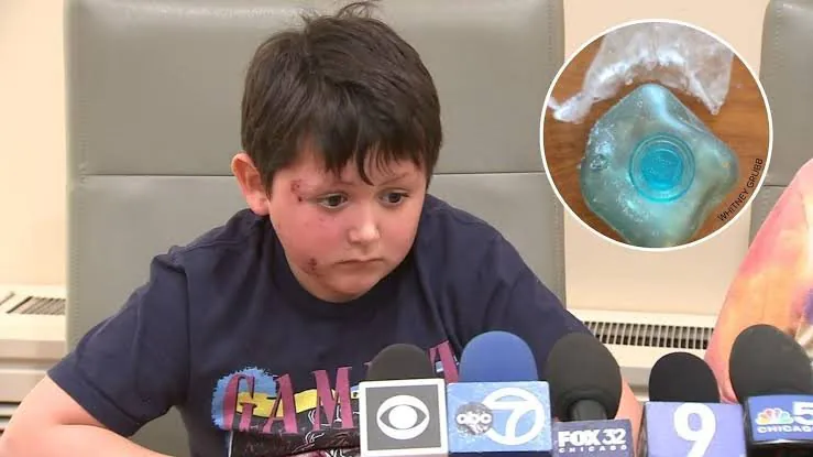 Viral Squishy Toy Chaos Kids Hospitalised With Severe Burns