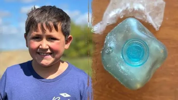 Squishy Toy Chaos Kids Hospitalised With Severe Burns - Second Image