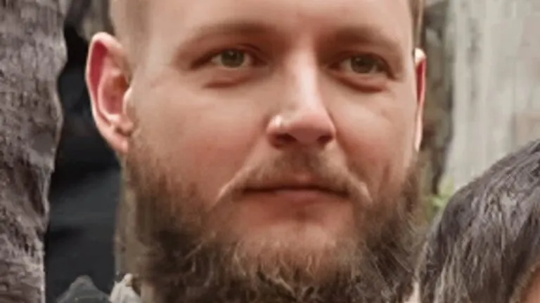 MP Attack Suspect’s Rare Neurological Condition Revealed in Court