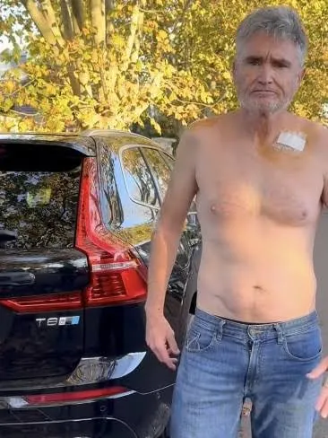 Comedian Dave Hughes Battles Skin Cancer Scare - Second Image